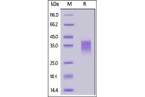 Human NKG2C, His Tag on  under reducing (R) condition. (KLRC2 Protein (AA 94-231) (His tag))