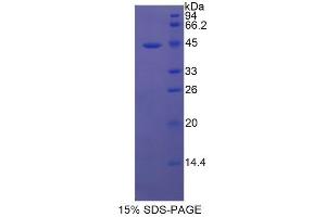 SDS-PAGE analysis of Human Tryptase Protein.