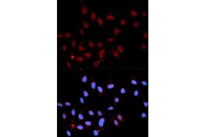 Immunofluorescence analysis of U2OS cell using Phospho-Stat3-Y705 antibody.