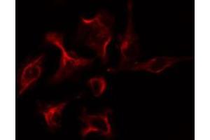 ABIN6274229 staining COLO205 cells by IF/ICC. (PRKAR1B antibody  (Internal Region))