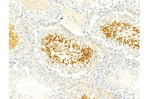 ABIN6266431 and ABIN6267067 at 1/100 staining Rat testis tissue by IHC-P.