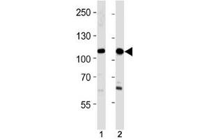 SALL4 antibody western blot analysis in 293,HeLa lysate. (SALL4 antibody  (AA 1009-1039))