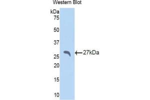 Western blot analysis of the recombinant protein. (APCS antibody  (AA 22-222))