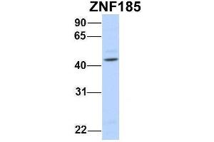 Host:  Rabbit  Target Name:  ZNF185  Sample Type:  Human Fetal Brain  Antibody Dilution:  1. (Zinc Finger Protein 185 antibody  (N-Term))