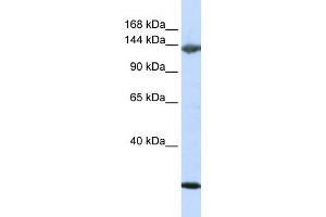 WB Suggested Anti-JAG2 Antibody Titration:  0. (JAG2 antibody  (N-Term))