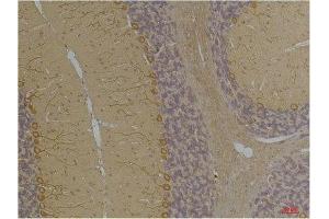 Immunohistochemistry (IHC) analysis of paraffin-embedded Rat Brain Tissue using Kv1. (KCNA10 antibody)
