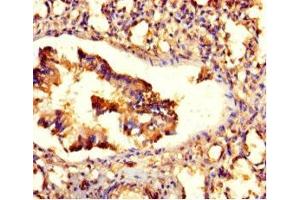 Immunohistochemistry of paraffin-embedded human lung tissue using ABIN7176521 at dilution of 1:100 (ZNF77 antibody  (AA 1-300))