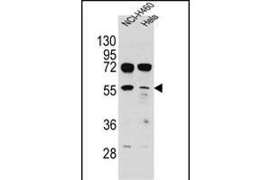 TSPYL6 Antibody (Center) (ABIN655239 and ABIN2844842) western blot analysis in NCI-,Hela cell line lysates (35 μg/lane). (TSPY-Like 6 antibody  (AA 206-235))