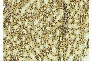 ABIN6277795 at 1/100 staining Mouse kidney tissue by IHC-P. (PRKACB antibody  (pThr197))