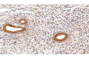 Immunohistochemistry (IHC) image for anti-High Mobility Group Box 1 (HMGB1) (AA 1-215) antibody (ABIN7431746)