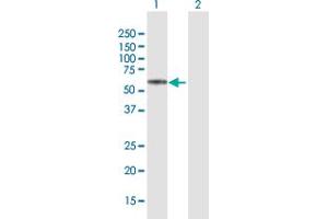 Western Blot analysis of KRT74 expression in transfected 293T cell line by KRT74 MaxPab polyclonal antibody. (KRT74 antibody  (AA 1-529))