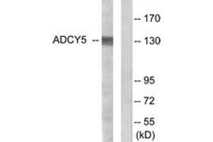 Western blot analysis of extracts from COLO205 cells, using ADCY5/6 Antibody. (ADCY5/6 antibody  (AA 931-980))