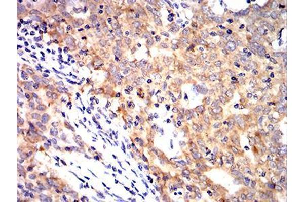 Keratin 10 antibody  (AA 345-454)