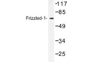 Image no. 1 for anti-Frizzled Family Receptor 1 (Fzd1) antibody (ABIN317638) (FZD1 antibody)