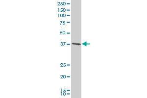 PXMP3 polyclonal antibody (A01), Lot # 051031JC01 Western Blot analysis of PXMP3 expression in HeLa . (PEX2 antibody  (AA 217-305))