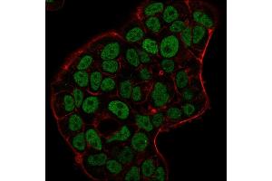 Immunofluorescence staining of MCF-7 cells using MSH6 Mouse Monoclonal Antibody (MSH6/3091) followed by goat anti-Mouse IgG conjugated to CF488 (green).