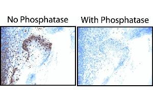 EGF Receptor (pY845) staining on tonsil. (EGFR antibody  (pTyr845))