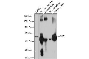 Western blot analysis of extracts of various cell lines, using CPB1 antibody (ABIN6131301, ABIN6138934, ABIN6138935 and ABIN6214759) at 1:1000 dilution. (CPB1 antibody  (AA 111-417))