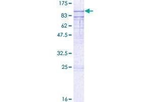 ESRP1 Protein (AA 1-681) (GST tag)