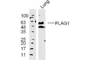 Lane 1: mouse lung lysates probed with 	PLAG1 Polyclonal Antibody, Unconjugated  at 1:300 overnight at 4˚C.