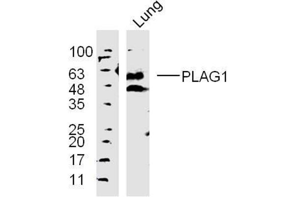 PLAG1 antibody  (AA 51-150)