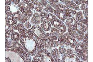 Image no. 2 for anti-Carboxypeptidase A2 (Pancreatic) (CPA2) antibody (ABIN1497596) (Carboxypeptidase A2 antibody)
