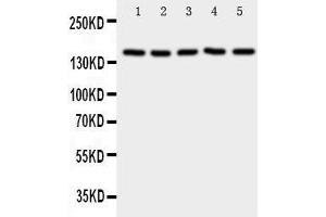 Western Blotting (WB) image for anti-Replication Factor C (Activator 1) 1, 145kDa (RFC1) (AA 46-64), (N-Term) antibody (ABIN3043075)