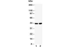 Western blot testing of BCAT1 antibody and Lane 1:  HeLa;  2: Jurkat cell lysate (BCAT1 antibody  (C-Term))