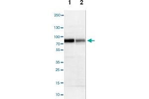 Western blot analysis of Lane 1: NIH-3T3 cell lysate (Mouse embryonic fibroblast cells), Lane 2: NBT-II cell lysate (Rat Wistar bladder tumour cells), Lane 3: PC12 cell lysate (Pheochromocytoma of rat adrenal medulla) with SOX9 polyclonal antibody at 1:100-1:500 dilution. (SOX9 antibody)