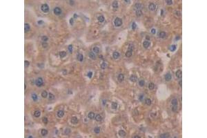 IHC-P analysis of Mouse Tissue, with DAB staining. (TPSAB1 antibody  (AA 149-273))