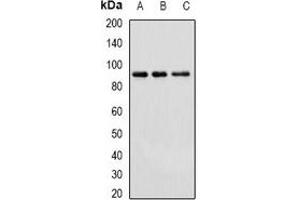 Western blot analysis of Cullin 4A expression in Hela (A), HepG2 (B), mouse brain (C) whole cell lysates. (Cullin 4A antibody)