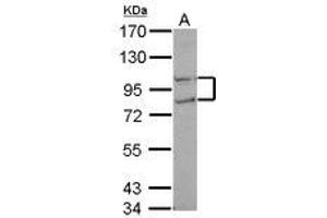 Image no. 1 for anti-CTD (Carboxy-terminal Domain, RNA Polymerase II, Polypeptide A) Phosphatase, Subunit 1 (CTDP1) (N-Term) antibody (ABIN1494011) (CTDP1 antibody  (N-Term))