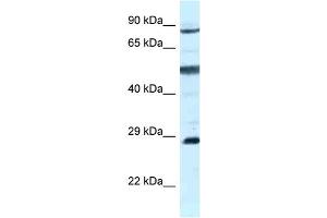 WB Suggested Anti-AK7 Antibody Titration: 1. (Adenylate Kinase 7 antibody  (C-Term))