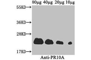 Western Blot Positive WB detected in: Coptis japonica (80 μg, 40 μg, 20 μg, 10 μg) All lanes: PR10A antibody at 3. (PR1a Precursor antibody  (AA 20-196))