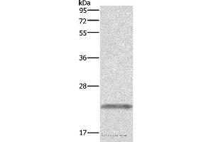 Western blot analysis of Human placenta tissue, using GH1 Polyclonal Antibody at dilution of 1:500 (Growth Hormone 1 antibody)