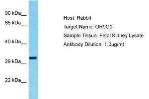 Host: Rabbit Target Name: OR9G9 Sample Type: Fetal Kidney lysates Antibody Dilution: 1. (OR9G9 antibody  (C-Term))