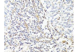 Immunohistochemistry of paraffin-embedded human tonsil using VIM antibody. (Vimentin antibody  (AA 1-101))