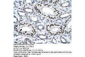 Immunohistochemistry (IHC) image for anti-Nuclear Receptor Subfamily 1, Group H, Member 4 (NR1H4) (Middle Region) antibody (ABIN2778066)
