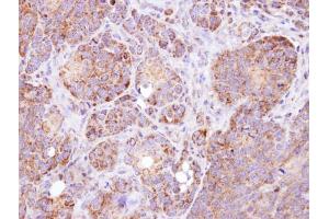 IHC-P Image Immunohistochemical analysis of paraffin-embedded SW480 xenograft, using MAAI, antibody at 1:100 dilution. (GSTZ1 antibody)