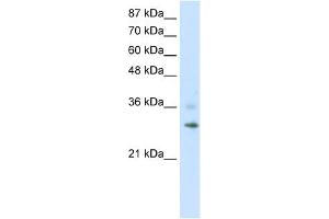 WB Suggested Anti-RNF113B Antibody Titration:  1. (RNF113B antibody  (C-Term))