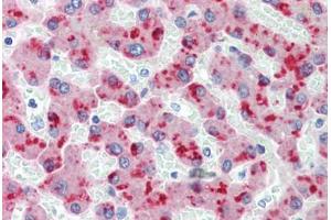 Human Liver (formalin-fixed, paraffin-embedded) stained with CFH antibody ABIN462334 followed by biotinylated anti-mouse IgG secondary antibody ABIN481714, alkaline phosphatase-streptavidin and chromogen. (Complement Factor H antibody)