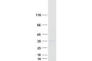 Western Blotting (WB) image for SplA/ryanodine Receptor Domain and SOCS Box Containing 1 (SPSB1) protein (Myc-DYKDDDDK Tag) (ABIN2732624)