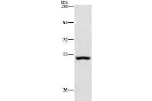 Western Blot analysis of Mouse kidney tissue using SYT17 Polyclonal Antibody at dilution of 1:650 (SYT17 antibody)