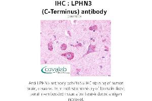 Image no. 1 for anti-Latrophilin 3 (LPHN3) (C-Term) antibody (ABIN1736541)