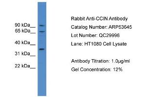 WB Suggested Anti-CCIN  Antibody Titration: 0. (Calicin antibody  (N-Term))