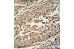 Immunohistochemistry analysis in formalin fixed and paraffin embedded human testis tissue reacted with FBXO24 Antibody  followed by peroxidase conjugation of the secondary antibody and DAB staining. (FBXO24 antibody  (Middle Region))