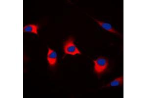 Immunofluorescent analysis of CDKL4 staining in MCF7 cells.