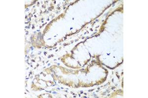 Immunohistochemistry of paraffin-embedded human stomach using NUDT15 antibody. (NUDT15 antibody)