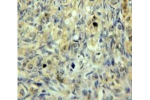 Used in DAB staining on fromalin fixed paraffin-embedded Ovary tissue (GSTM3 antibody  (AA 8-223))