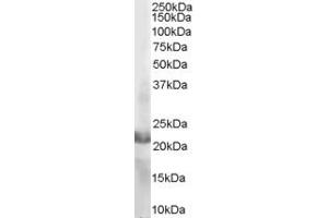 ABIN184689 staining (2µg/ml) of MOLT-4 lysate (RIPA buffer, 35µg total protein per lane). (RAC2 antibody  (C-Term))